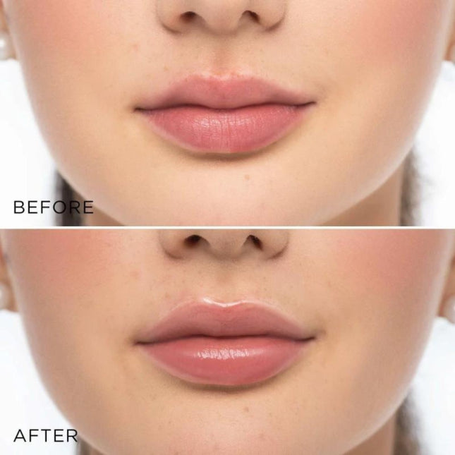 Artdeco Glossy Lip Volumizer - 6ml