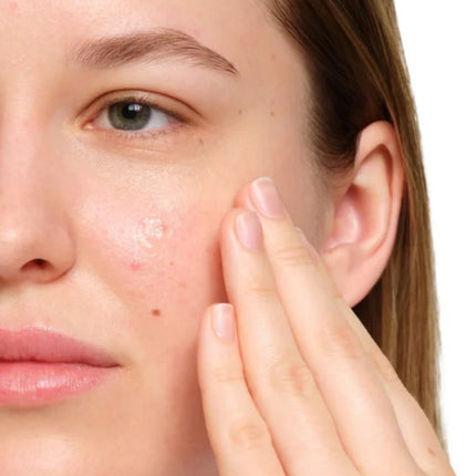 The Ordinary Salicylic Acid 2% Anhydrous Solution - 30ml