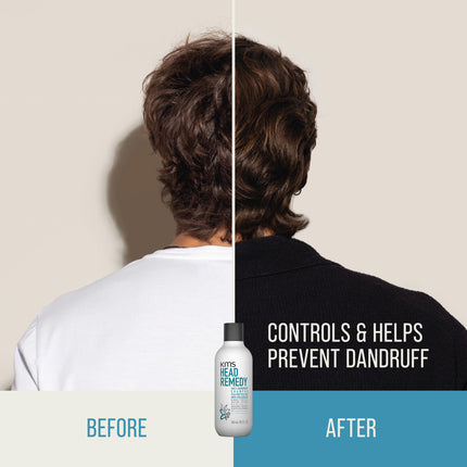 KMS Hair Head Remedy Anti-Dandruff Shampoo - 300ml