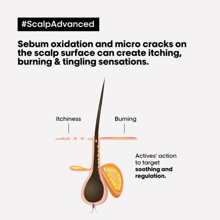 L'Oreal SE Scalp Advanced Anti-Discomfort Shampoo - 1500ml