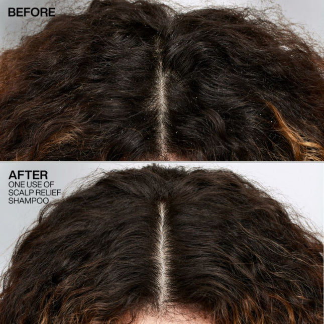 Redken Scalp Relief Dandruff Control Shampoo - 250ml